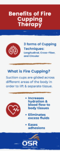 Benefits of fire cupping therapy