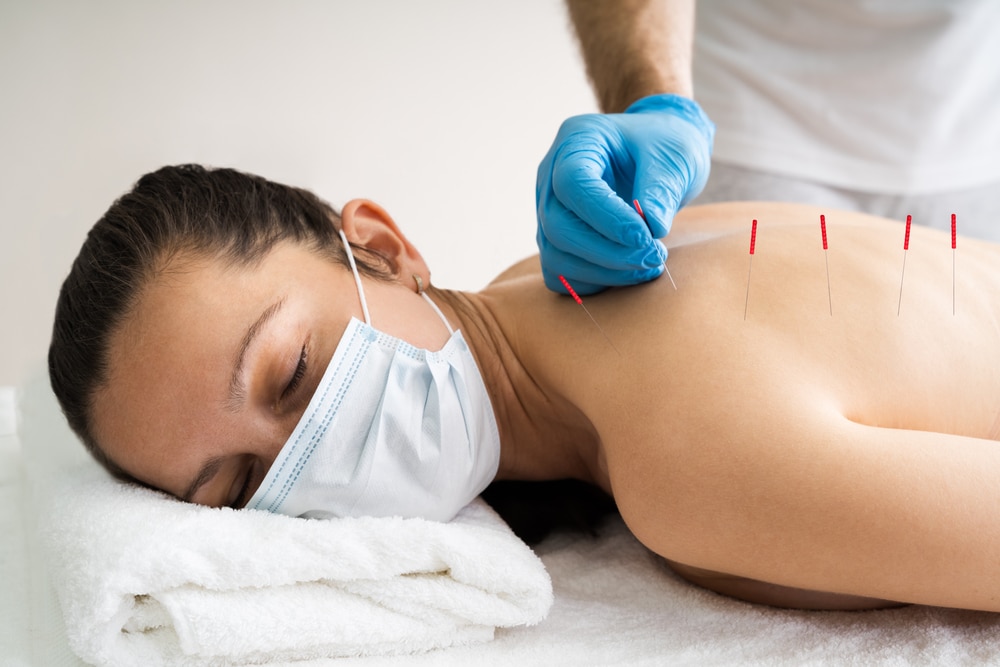 Acupuncture treatment vs dry needling treatment