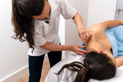 physician performing dry needling therapy on patient